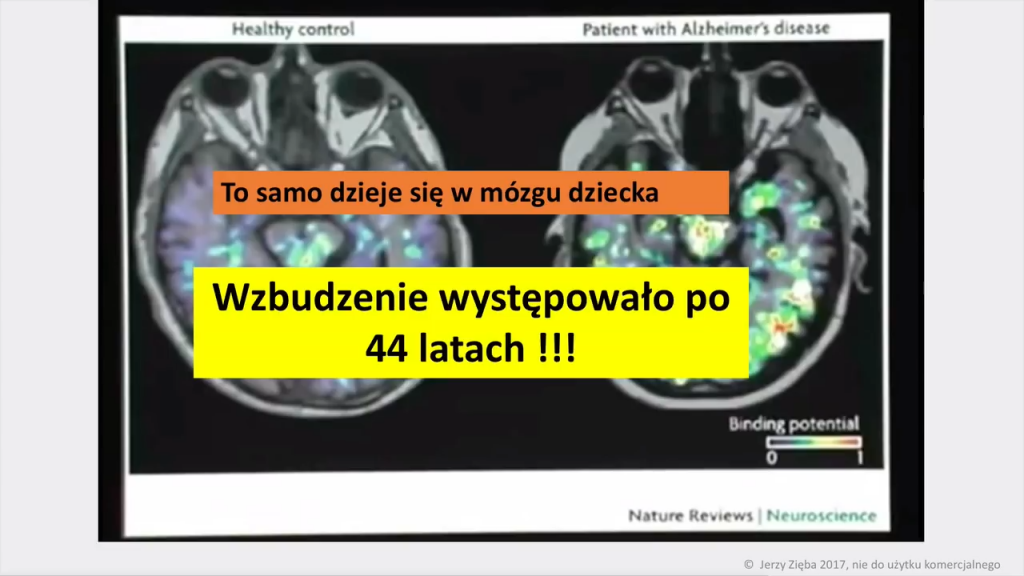 Jerzy Zięba - Szczepionki cz. 2/7